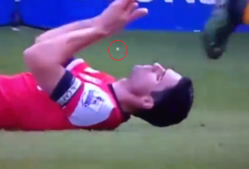 Video bóng đá: Pha va chạm khiến Mikel Arteta gãy răng cửa